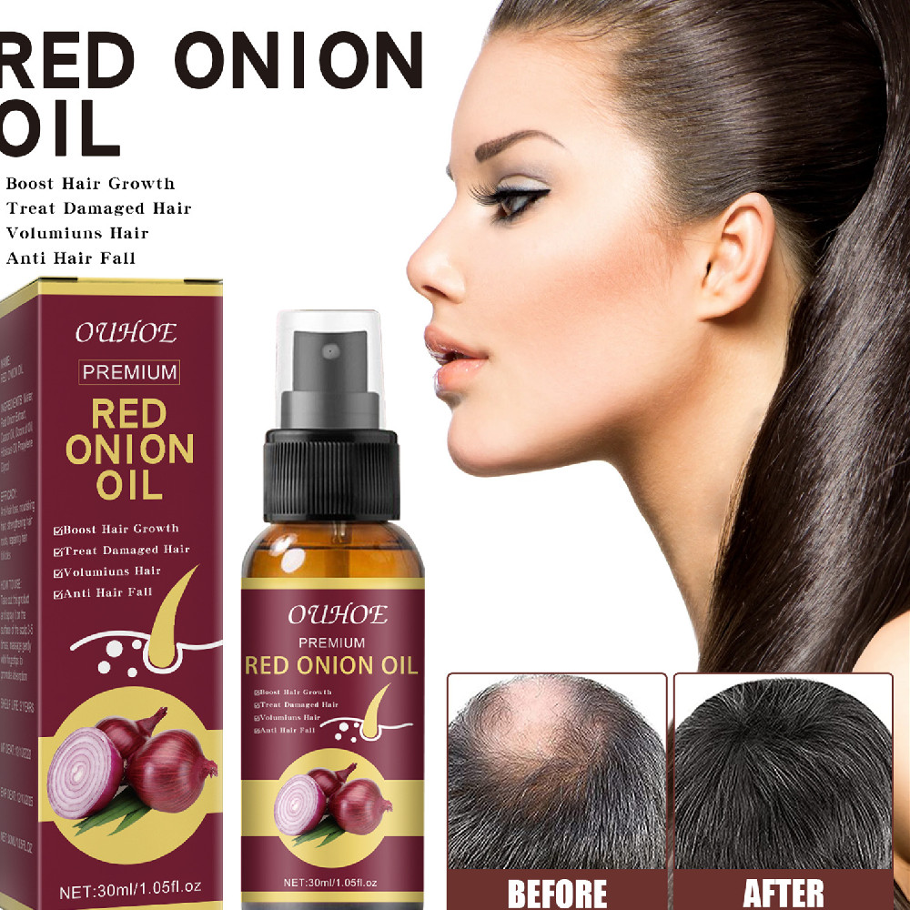 Onion Root Strengthening Spray